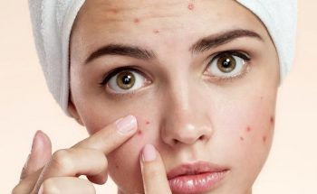 Acne-Treatment Acne-Treatment